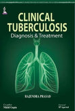 Clinical Tuberculosis: Diagnosis & Treatment