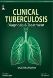 Clinical Tuberculosis: Diagnosis & Treatment