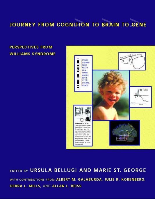 Journey from Cognition to Brain to Gene – Perspectives from Williams Syndrome